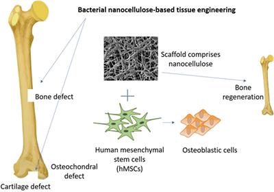 Perspective Applications and Associated Challenges of Using Nanocellulose in Treating Bone-Related Diseases